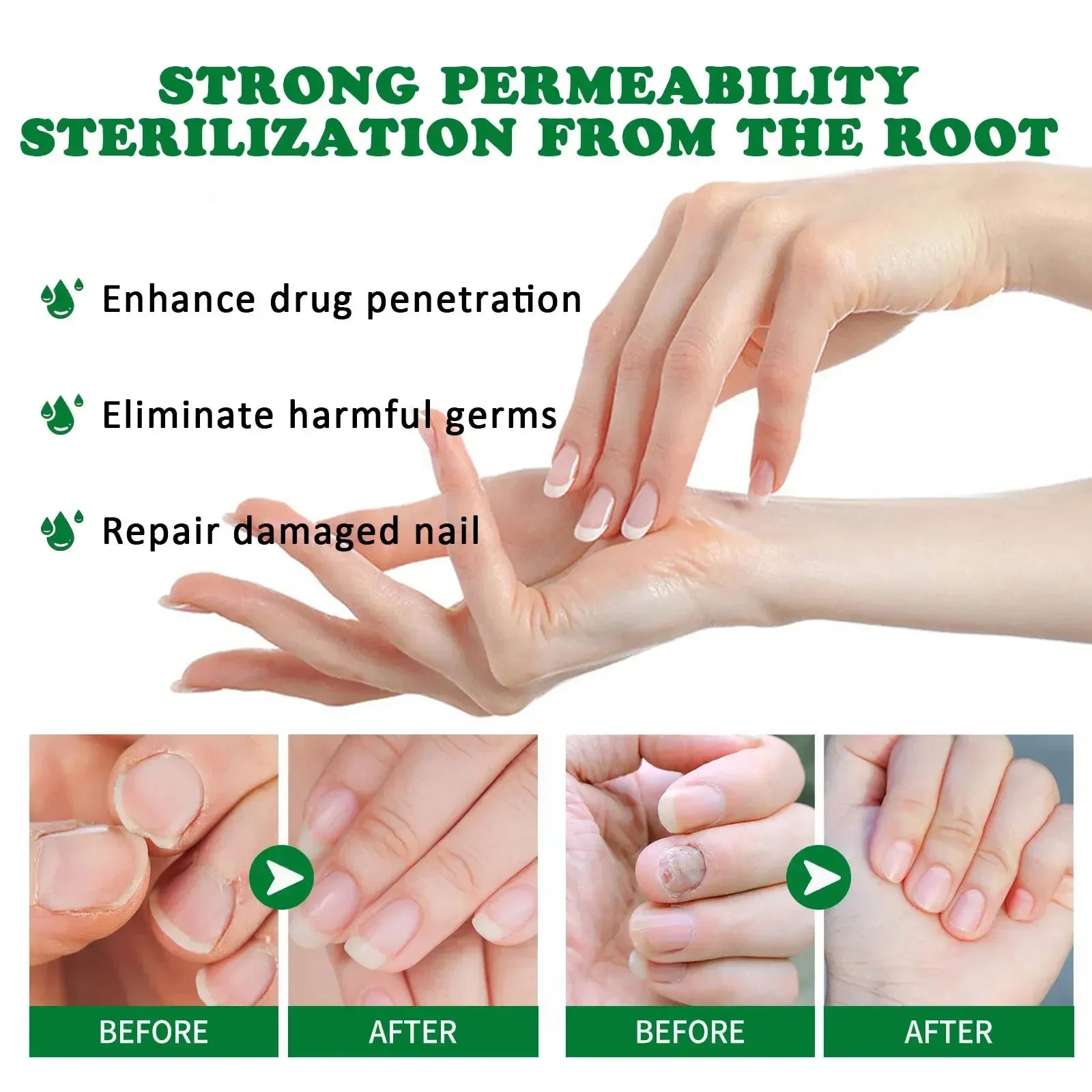 Extra Strong Nail Fungus Treatment Serum – Essence Oil for Toe & Foot Repair