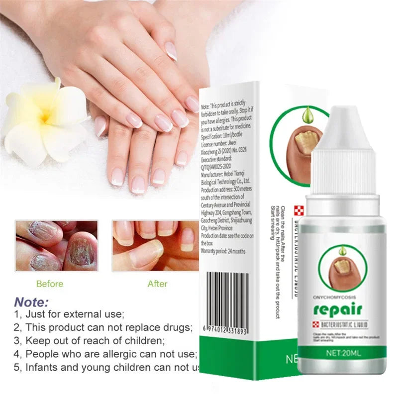 Nail Fungus Treatment Serum – Anti-Infection & Fungal Repair Gel for Toes and Hands