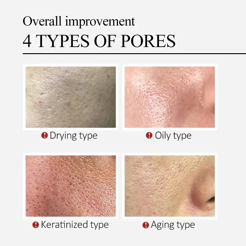 Salicylic Acid Pore Shrinking Cream | Quick Blackhead Removal | Smooths Skin, Tightens Face | Eliminates Large Pores | Korean Skincare Product