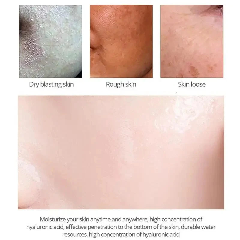 Salicylic Acid Pore Shrinking Cream | Quick Blackhead Removal | Smooths Skin, Tightens Face | Eliminates Large Pores | Korean Skincare Product