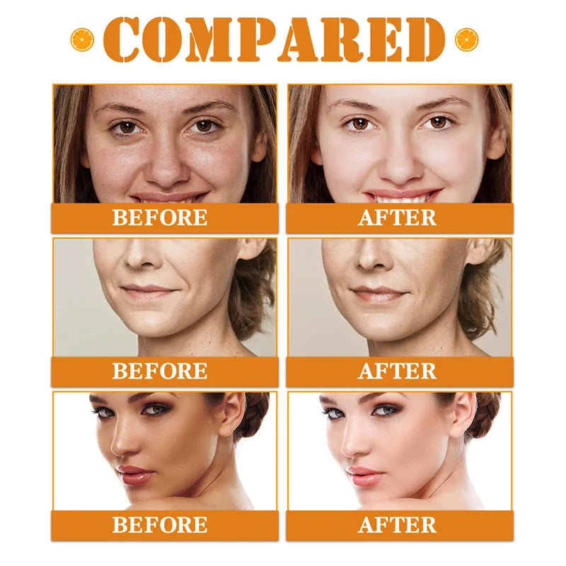 10% Alpha Arbutin + 5% Mandelic Acid Serum: Whitening, Brightening & Anti-Acne Essence