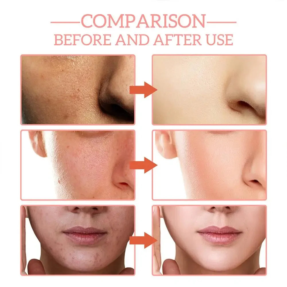 5 In 1 Anti-Wrinkle, Anti-Aging Face Serum | Hyaluronic Acid, Niacinamide | Shrinks Pores, Fades Spots | Whitening Skin Care