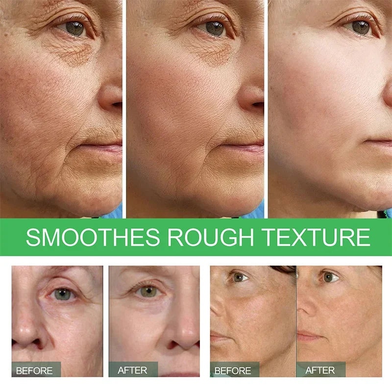Anti-Wrinkle Serum | Whitening, Lifting, Firming | Fine Lines Serum | Anti-Aging, Nourishing | Facial Skin Serum | New Skin Anti-Wrinkle
