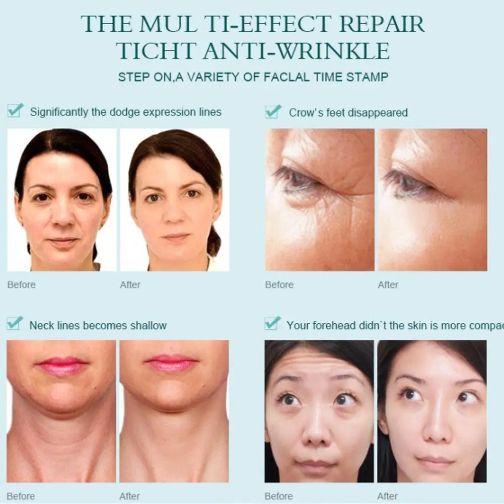 10ml Altı Peptit Serum | Sıvı Koenzim Q10 | Hyaluronik Asit | Kırışıklık Karşıtı | VC Beyazlatma | Kolajen Yüz Germe | Cilt Bakım Kremi