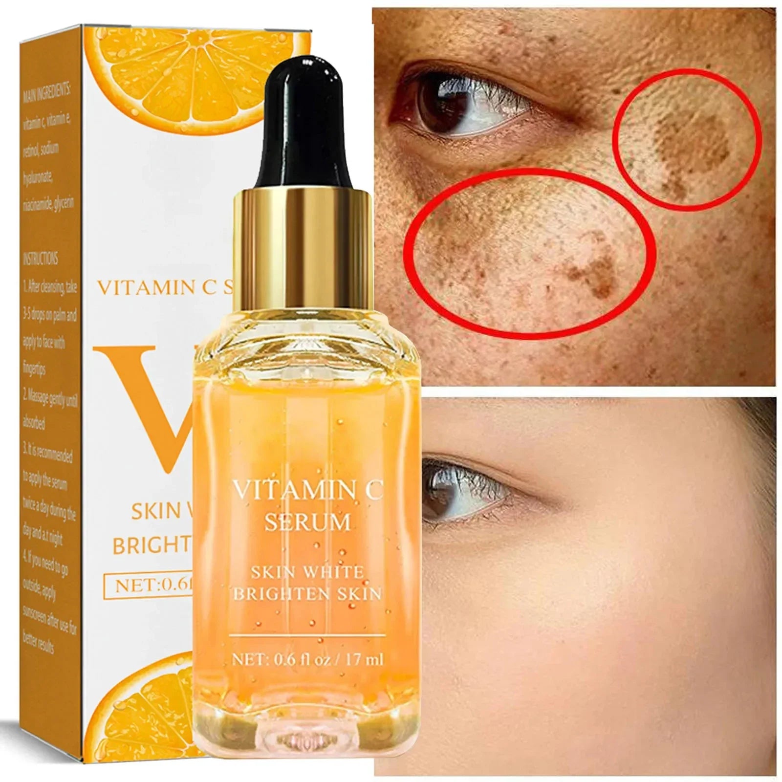 C Vitamini ve Retinol Koyu Leke Giderici Serum – Beyazlatıcı ve Çil Soldurucu Kırışıklık Karşıtı Öz
