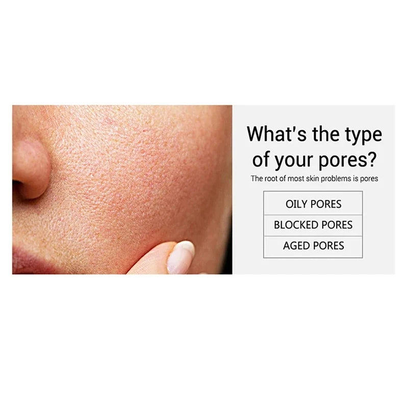 Salicylic Acid Pore Shrinking Cream | Quick Blackhead Removal | Smooths Skin, Tightens Face | Eliminates Large Pores | Korean Skincare Product