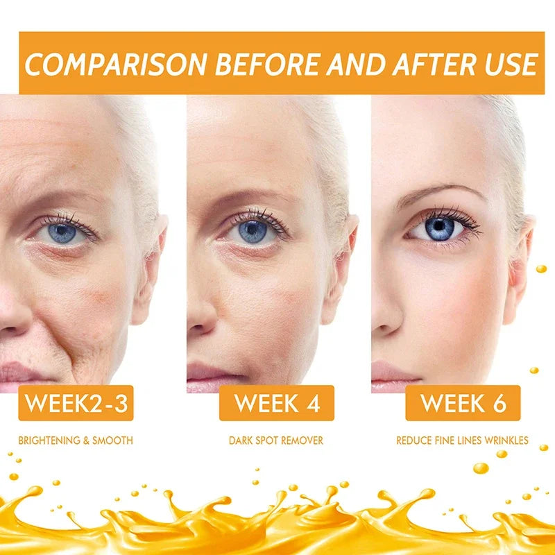 C Vitamini ve Retinol Koyu Leke Giderici Serum – Beyazlatıcı ve Çil Soldurucu Kırışıklık Karşıtı Öz
