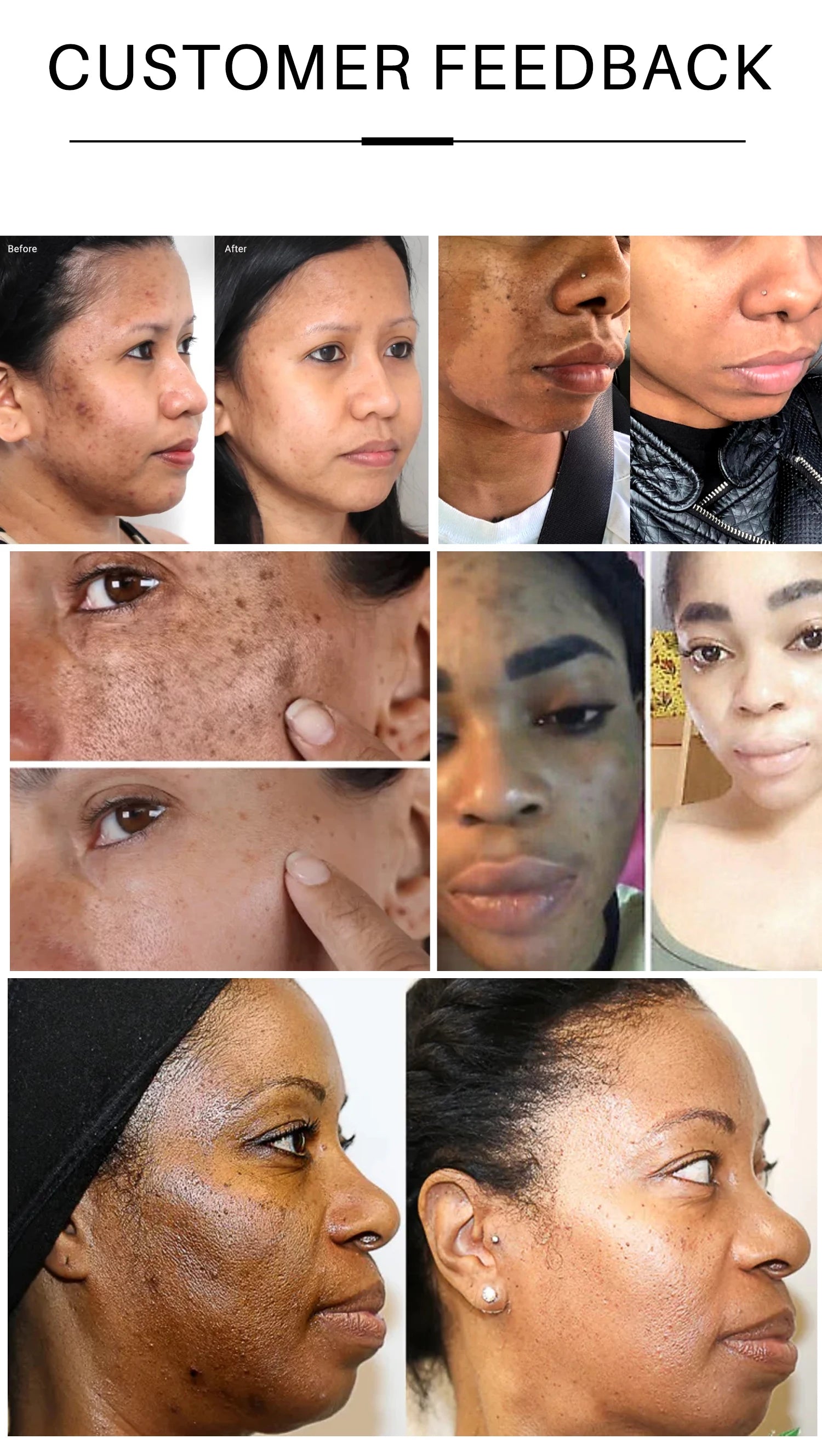 50g C Vitamini Aydınlatıcı Serum Lekeleri Azaltır ve Antioksidanlar Nemlendirici Sıkılaştırıcı Pürüzsüz Cilt Bakımı