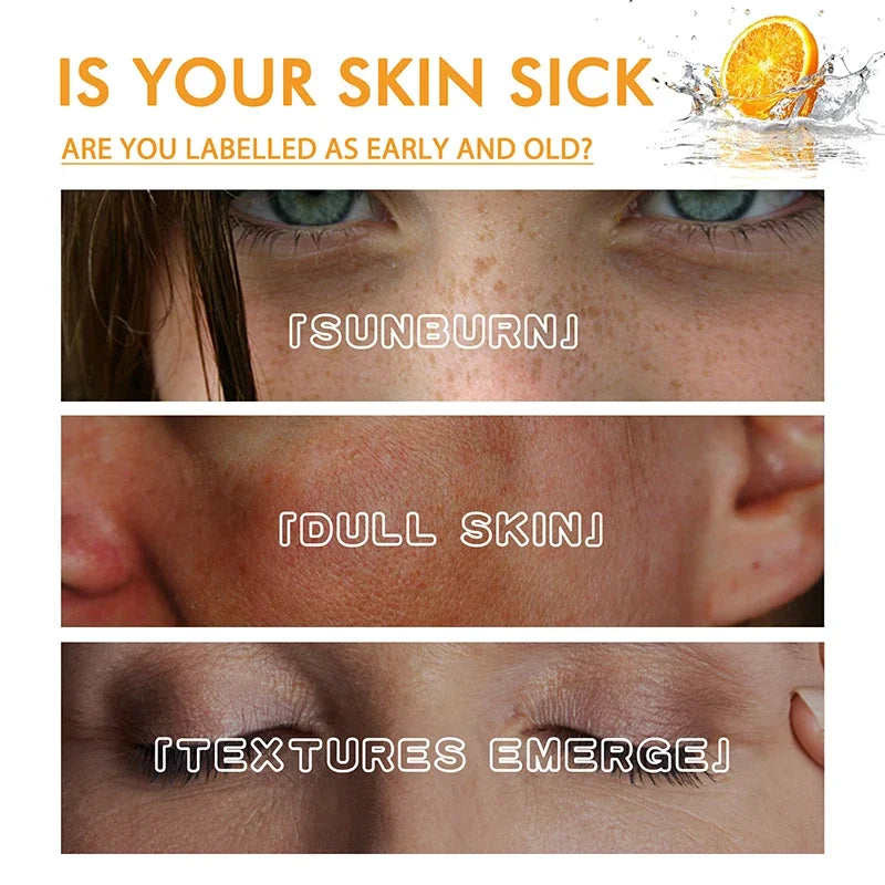C Vitamini ve Retinol Koyu Leke Giderici Serum – Beyazlatıcı ve Çil Soldurucu Kırışıklık Karşıtı Öz