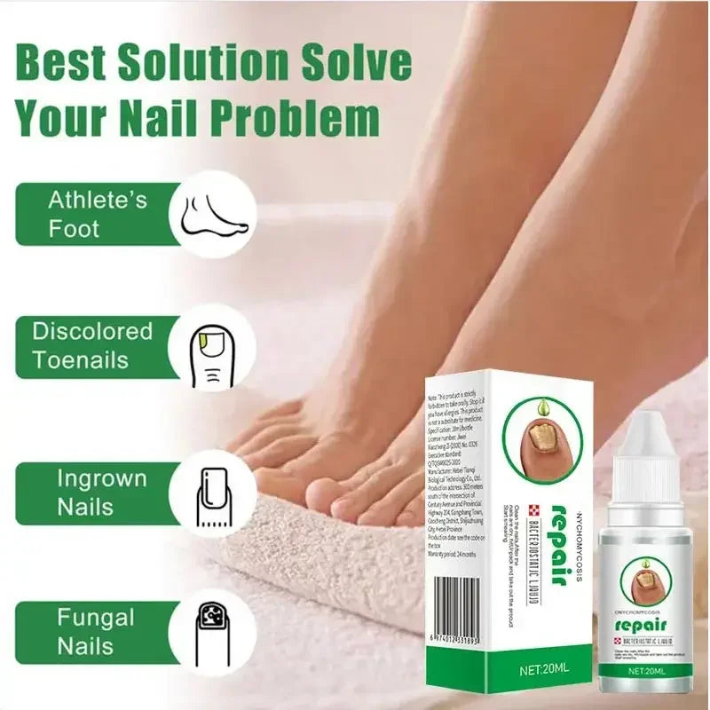 Nail Fungus Treatment Serum – Anti-Infection & Fungal Repair Gel for Toes and Hands