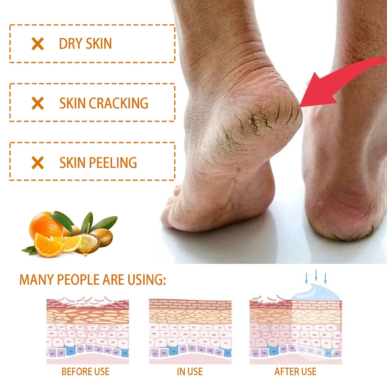 Intensive Heel Repair Anti-Crack Foot Cream