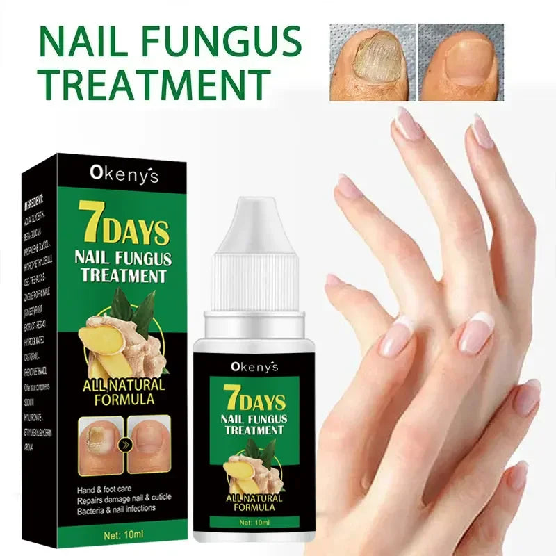 Extra Strong Nail Fungus Treatment Serum – Essence Oil for Toe & Foot Repair
