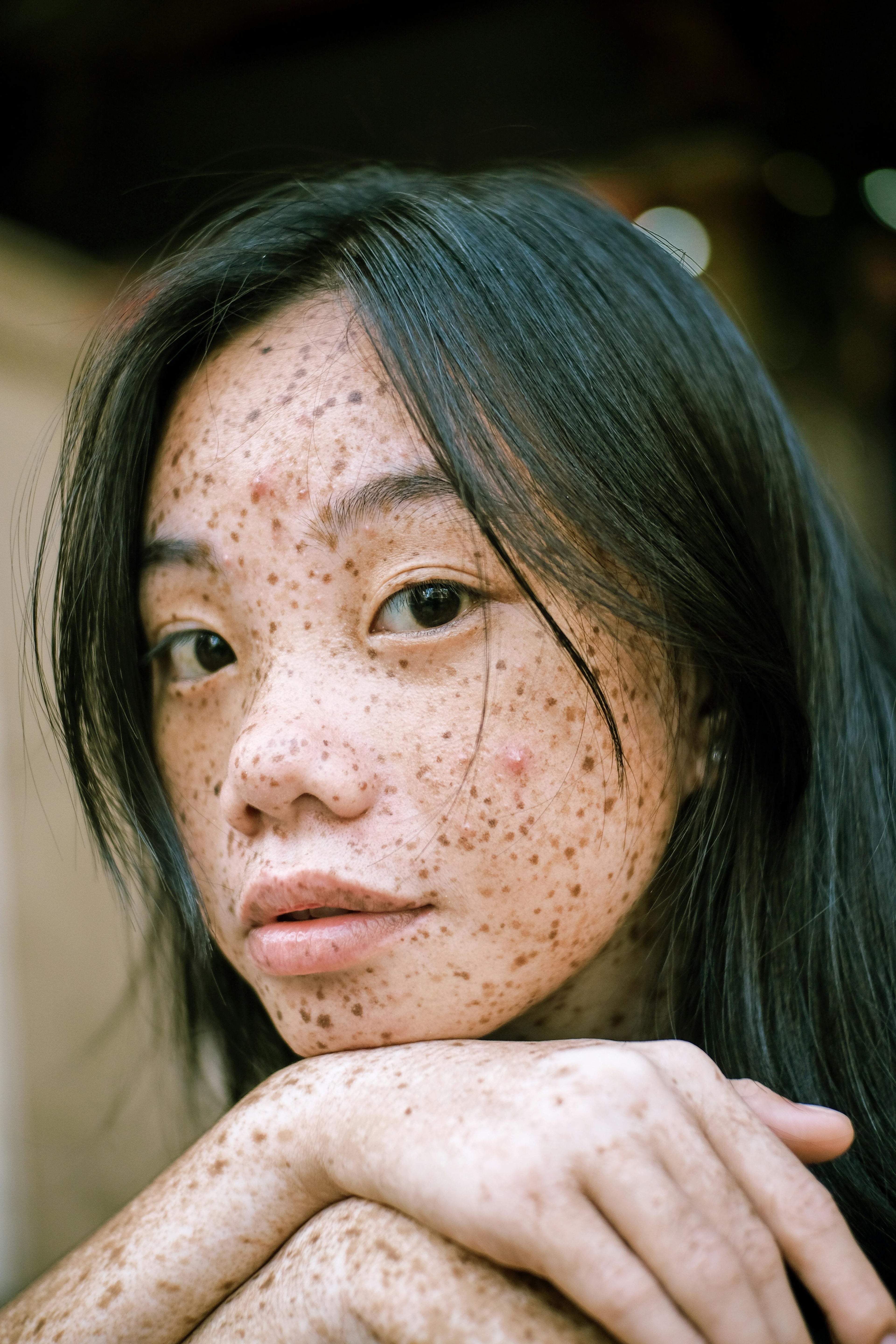 FreckleTreat & Glow