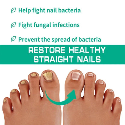 Nail Fungus Treatment Serum – Anti-Infection &amp; Fungal Repair Gel for Toes and Hands