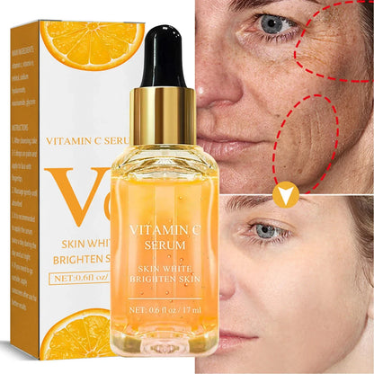 C Vitamini ve Retinol Koyu Leke Giderici Serum – Beyazlatıcı ve Çil Soldurucu Kırışıklık Karşıtı Öz