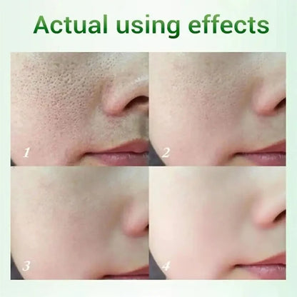 Salicylic Acid Pore Shrinking Cream | Quick Blackhead Removal | Smooths Skin, Tightens Face | Eliminates Large Pores | Korean Skincare Product