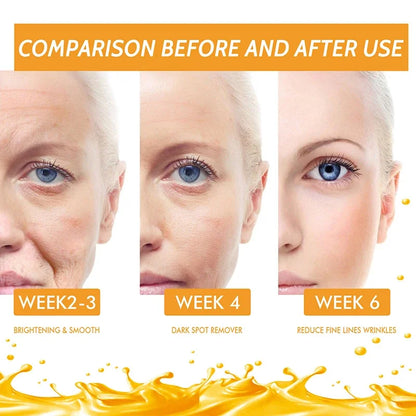 C Vitamini ve Retinol Koyu Leke Giderici Serum – Beyazlatıcı ve Çil Soldurucu Kırışıklık Karşıtı Öz