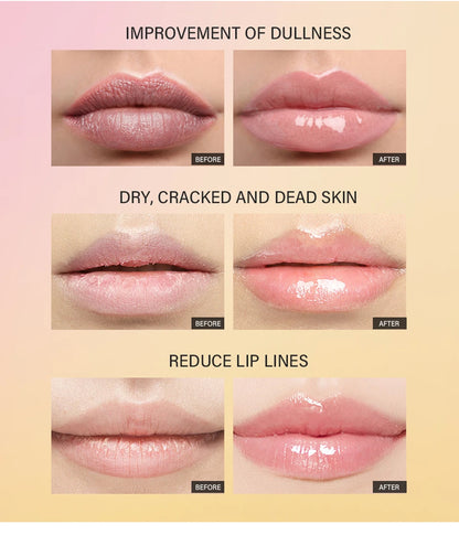 Moisturizing Peptide Lip Treatment | Lip Mask Gel | Removes Dead Skin | Lipstick Base | Lip Cream | Lip Care Mask | 10ml | 1 Piece