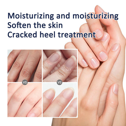 &quot;Herbal Wrinkle Remover Hand Cream – Anti-Crack &amp; Moisturizing Hand Lotion&quot;