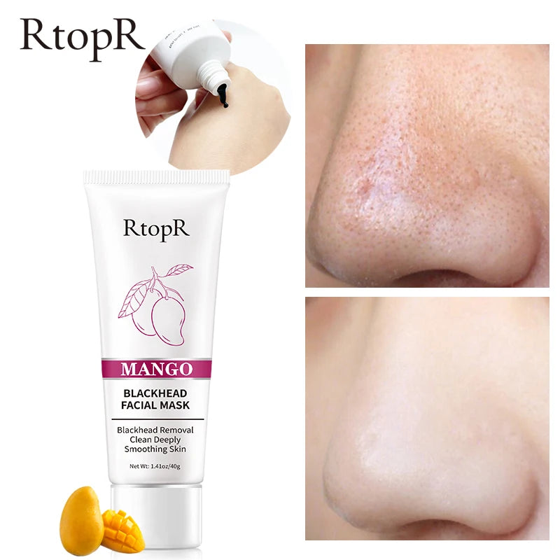 Mango Blackhead Remover &amp; Pore Strip | Facial Cleansing &amp; Pore Shrinking | Firming &amp; Acne Treatment | Whitening Nose Pack
